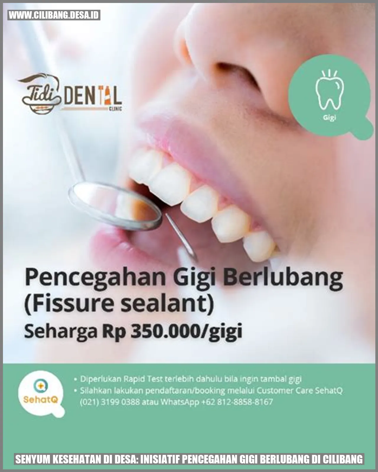 Senyum Kesehatan di Desa: Inisiatif Pencegahan Gigi Berlubang di Cilibang